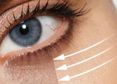 10 روش که می تواند سیاهی دور چشم را از بین ببرد